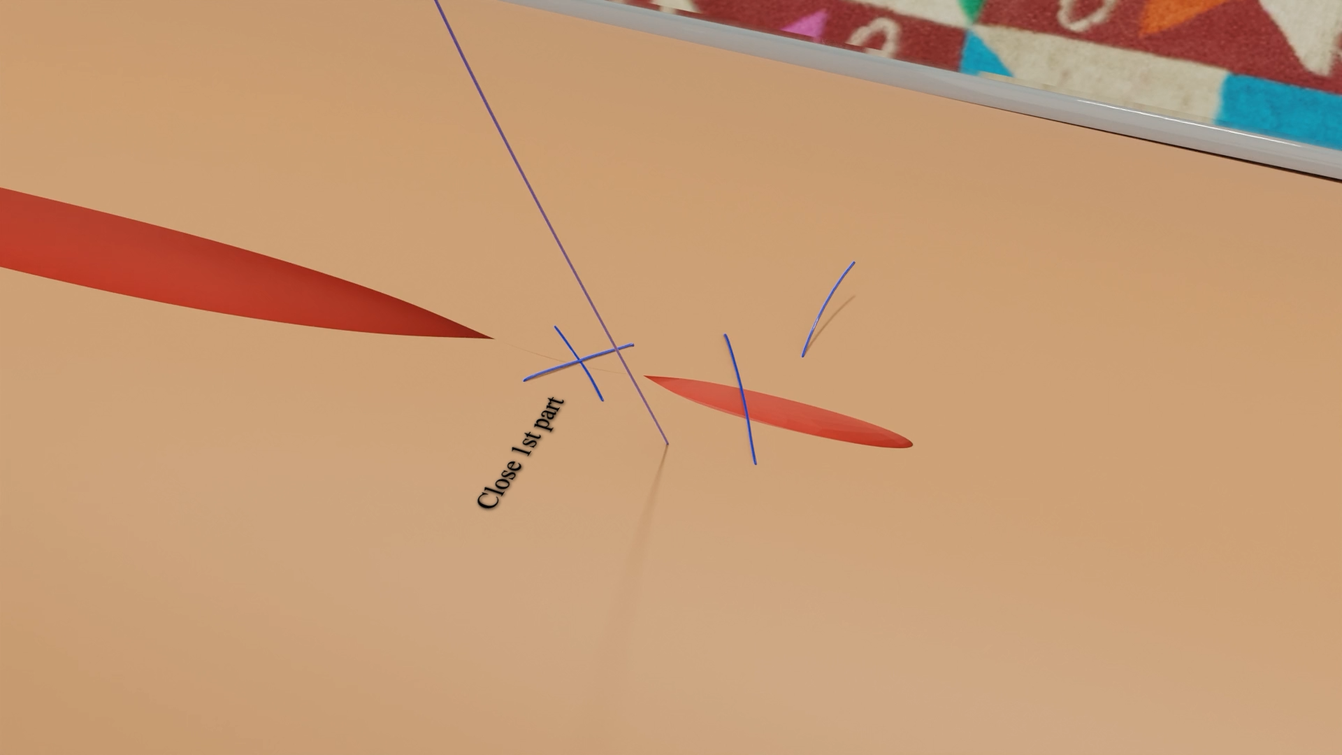 Running Cruciate Suture