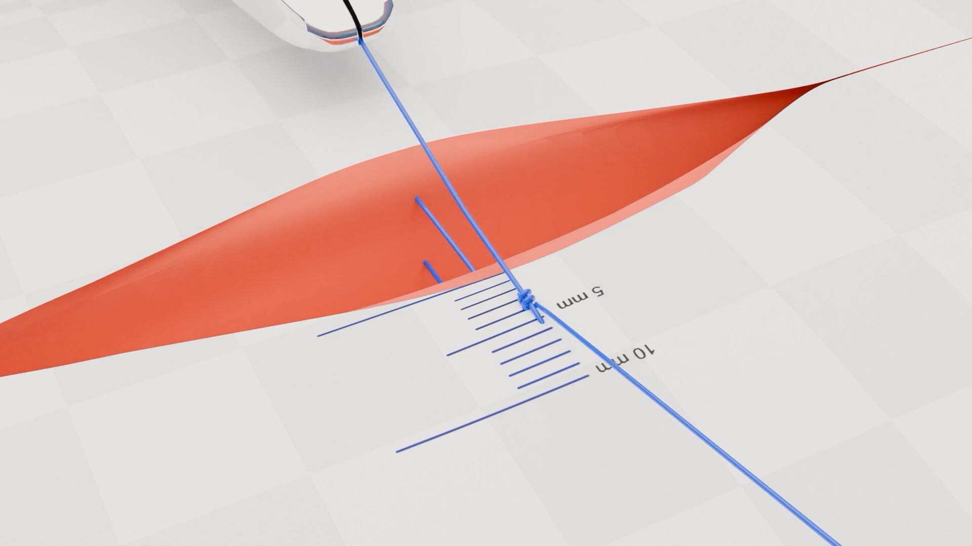 Half Buried Vertical Mattress Suture